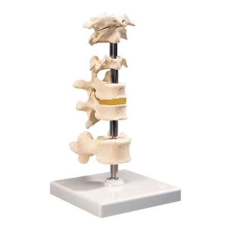 Fabrication Enterprises 3B Anatomical Model - 5 Mounted Vertebrae with Removable Stand 984300